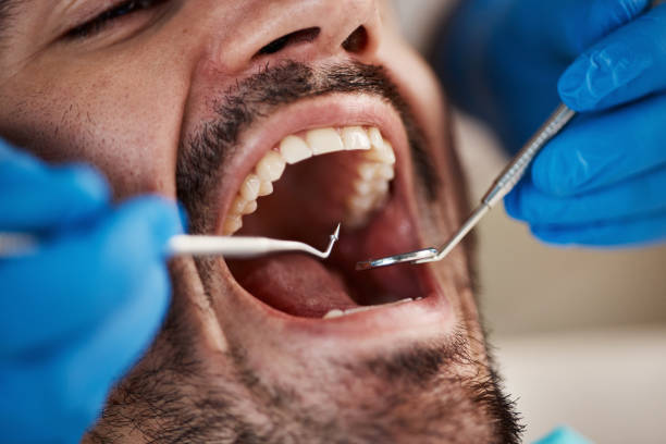Best Emergency Care for Gum Disease in Glenolden, PA
